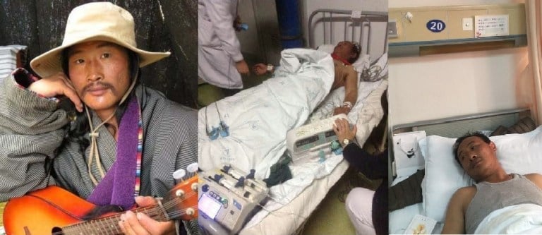 雪努班登被释​​放后在当地的一家医院接受治疗 照片/载自网络